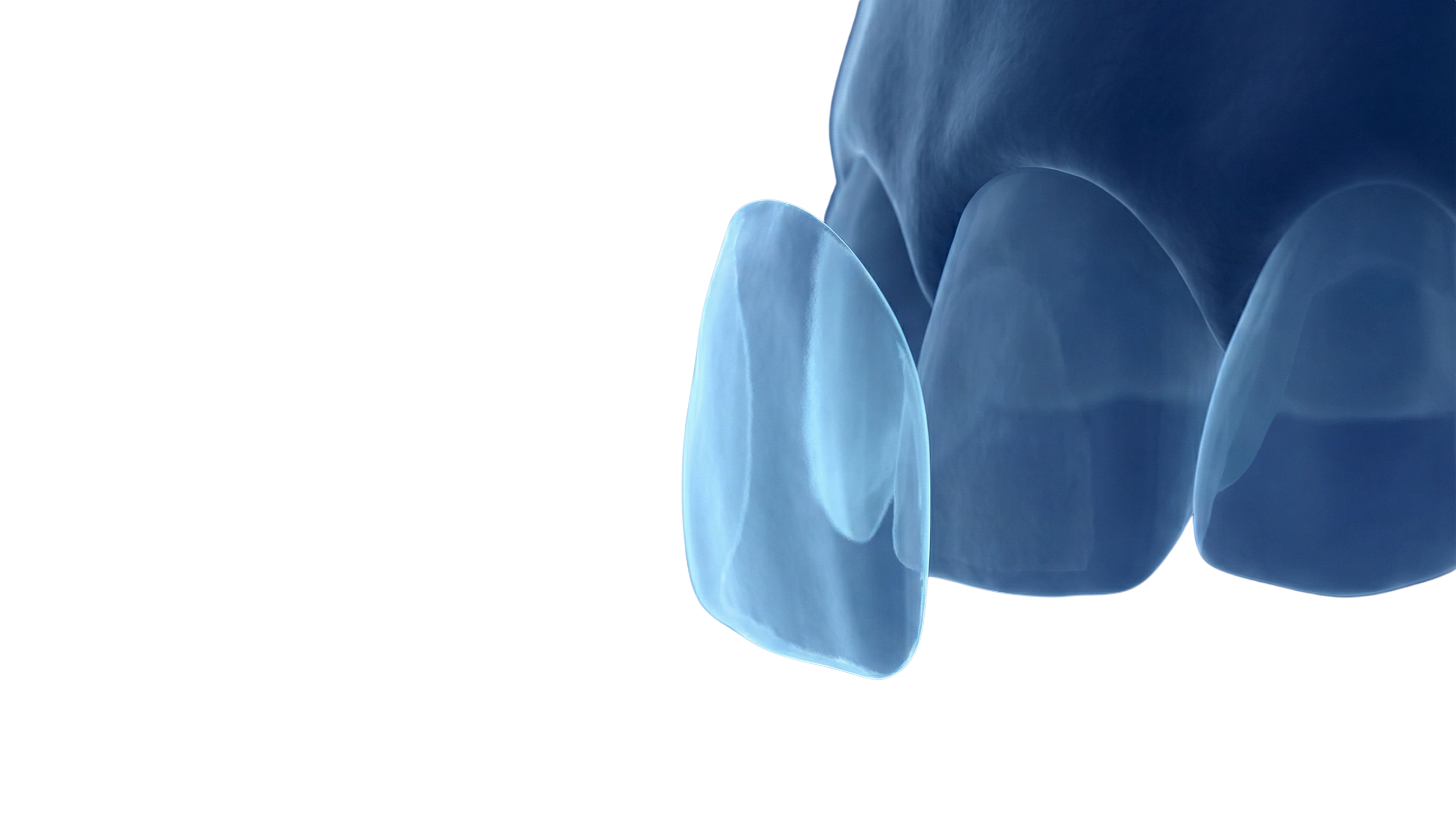 Asthetische Zahnheilkunde